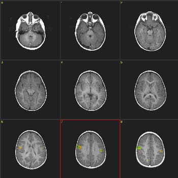 E17195S10a.jpg E17195S10a.jpg