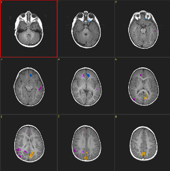 Sedated17195S9.jpg Sedated17195S9.jpg