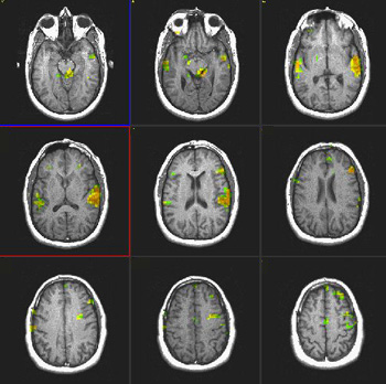 verbalcomprehension.jpg verbalcomprehension.jpg