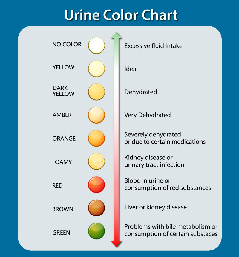 urine-color-chart.jpg urine-color-chart.jpg