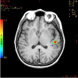 008_11.jpg 008_11.jpg