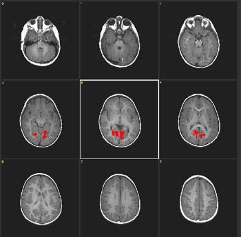 E17195S10b.jpg E17195S10b.jpg