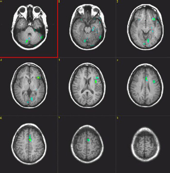 verbalfluency.jpg verbalfluency.jpg