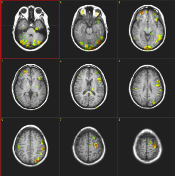 semanticfluency.jpg semanticfluency.jpg